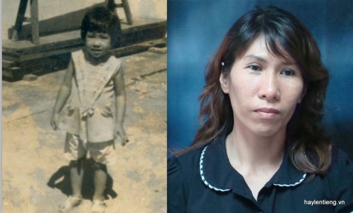 Chị Lê Thị Kim Lan lúc nhỏ và hiện tại