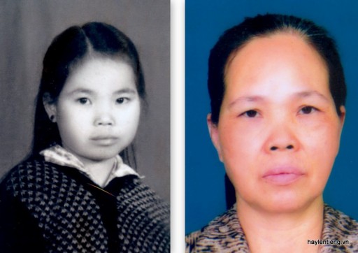 Bà Lại Thị Minh Chi lúc trẻ và hiện tại